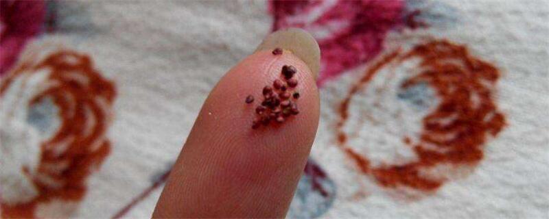 山地玫瑰如何繁殖